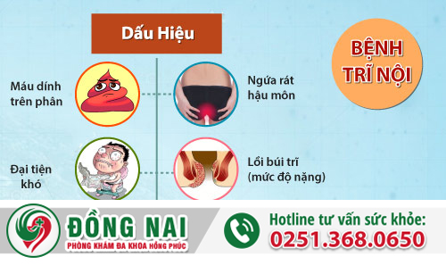 Dấu hiện trĩ nội điển hình