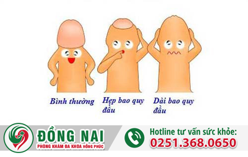 6 nguyên nhân gây bệnh viêm bao quy đầu ở nam giới