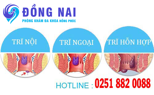 bệnh trĩ