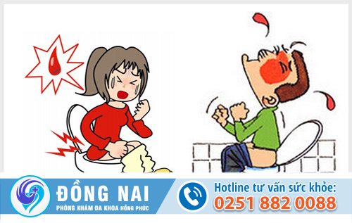 Bệnh trực tràng hậu môn thường gặp và những tác hại nguy hiểm