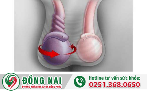 Chữa trị vô sinh nam giới – không phải là không thể