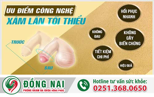 Dài bao quy đầu phải chữa trị làm sao?