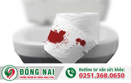 Đại tiện ra máu là do đâu? Có nguy hiểm không?