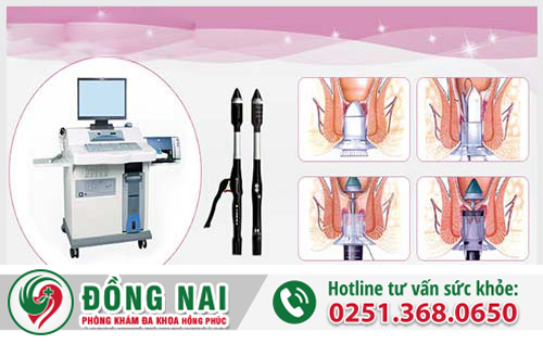 Cục thịt thừa ở hậu môn là bệnh gì? Có gây nguy hiểm gì không? Cách chữa và điều trị ra sao?