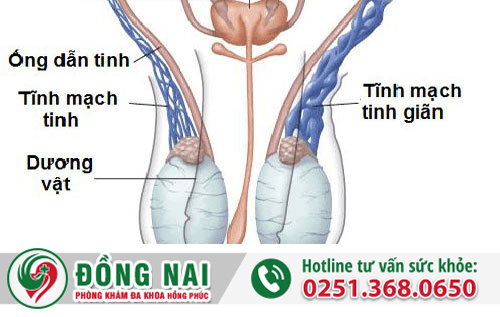 Đau tinh hoàn – Bệnh lý không nên xem thường