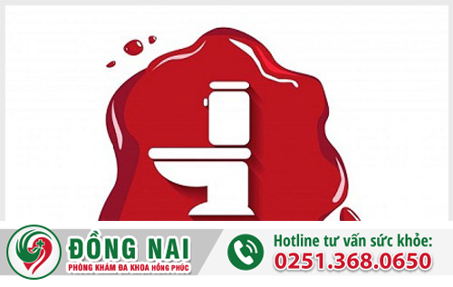 Đi cầu ra máu nhưng không đau là dấu hiệu bệnh gì?