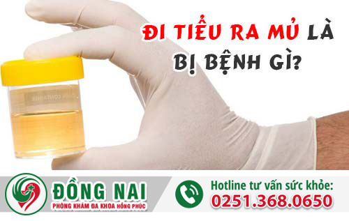 Đi tiểu ra mủ là bị bệnh gì?