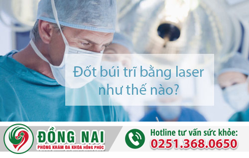 Đốt búi trĩ bằng laser như thế nào?