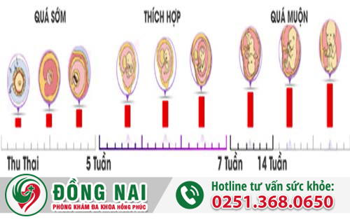 Giai đoạn nào phá thai tốt và an toàn nhất