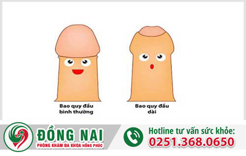 Giải thích hiện tượng dài bao quy đầu và phương pháp điều trị