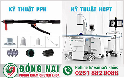 Những Phương Pháp Chữa Bệnh Trĩ Hiệu Quả Hiện Nay