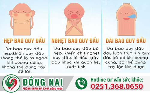 Khám nam khoa là khám những bệnh gì