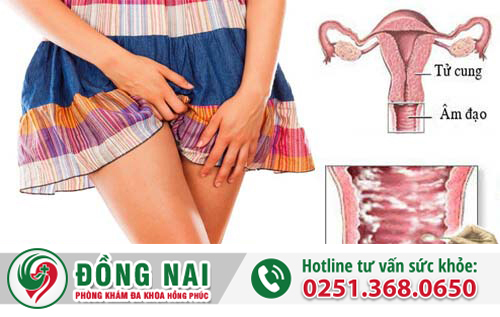Năm dấu hiệu cảnh báo chị em về bệnh phụ khoa