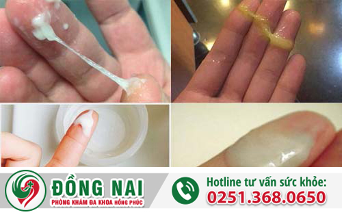 Nguyên nhân khí hư ra nhiều là gì?