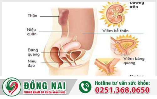 Bệnh lý đường tiết niệu