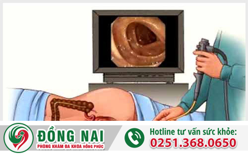 Nội soi hậu môn trực tràng là như thế nào?