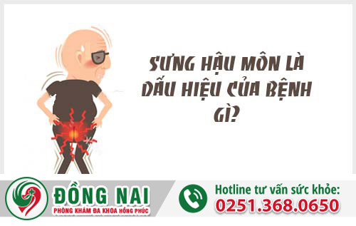 Sưng hậu môn là dấu hiệu của bệnh gì?