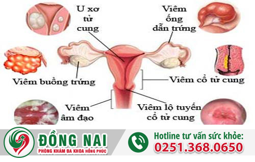 Tại sao phụ nữ bị kinh nguyệt không đều?