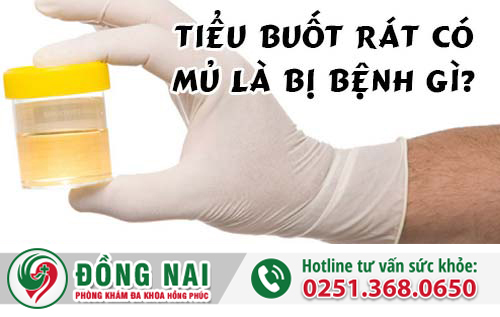 Tiểu buốt rát có mủ là bị bệnh gì?