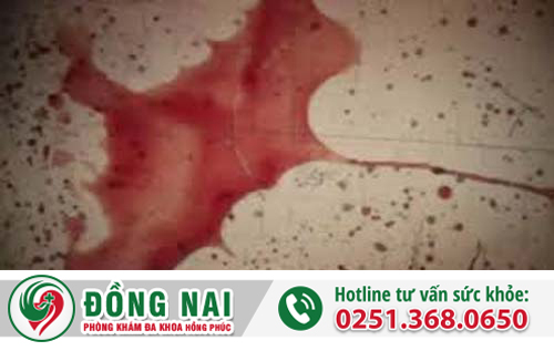 Tổng quan về bệnh xuất tinh ra máu