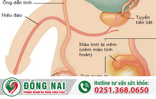 đi tiểu nhiều lần ở nam giới