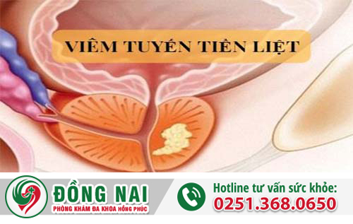 Viêm tuyến tiền liệt nam giới – Chi phí điều trị ra sao?