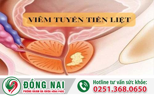 Viêm tuyến tiền liệt